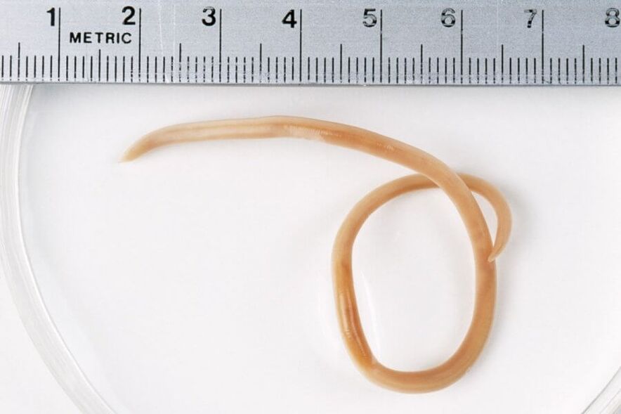 pinworm uit het menselijk lichaam