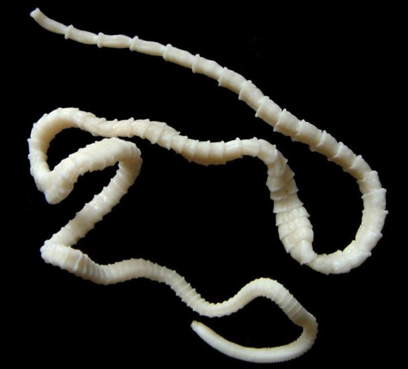 menselijke lintworm
