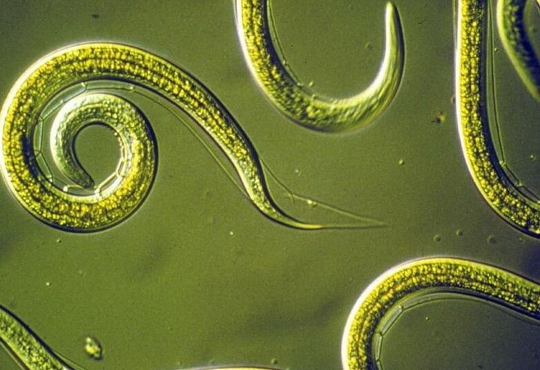 rondwormen uit het menselijk lichaam