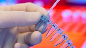 Hoe u tests kunt doen voor parasieten