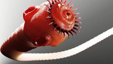 soorten parasieten in het menselijk lichaam