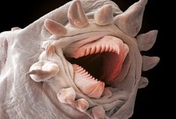 welke wormen kunnen in het menselijk lichaam leven