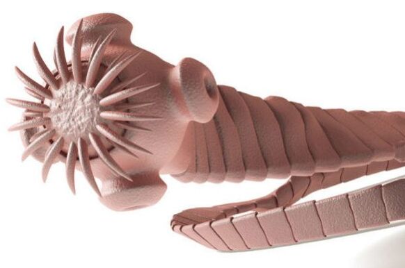 parasiet uit het menselijk lichaam