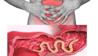 symptomen van de aanwezigheid van parasieten in de menselijke darm