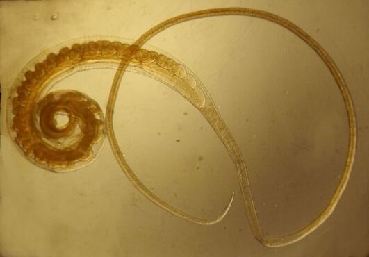 Trichinella-worm uit het menselijk lichaam